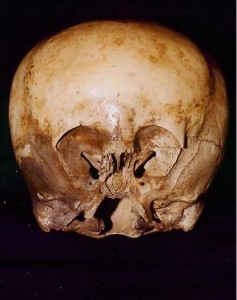 Starchild_skull CREDIT AlienVideo.net SOURCE Wikipedia (Fair Use)